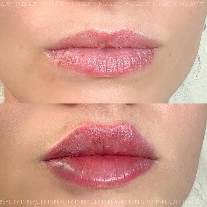 InBeauty Iuliana Aesthetics LTD image 1