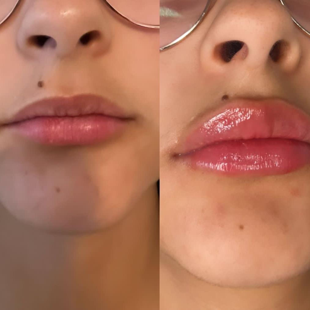 L'luxe Aesthetics image 3