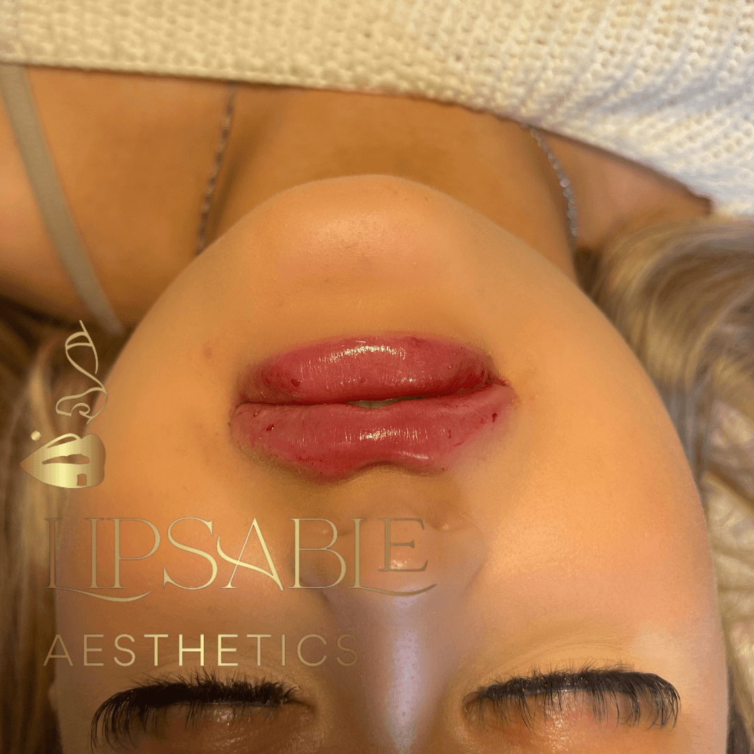 Lipsable aesthetics image 3