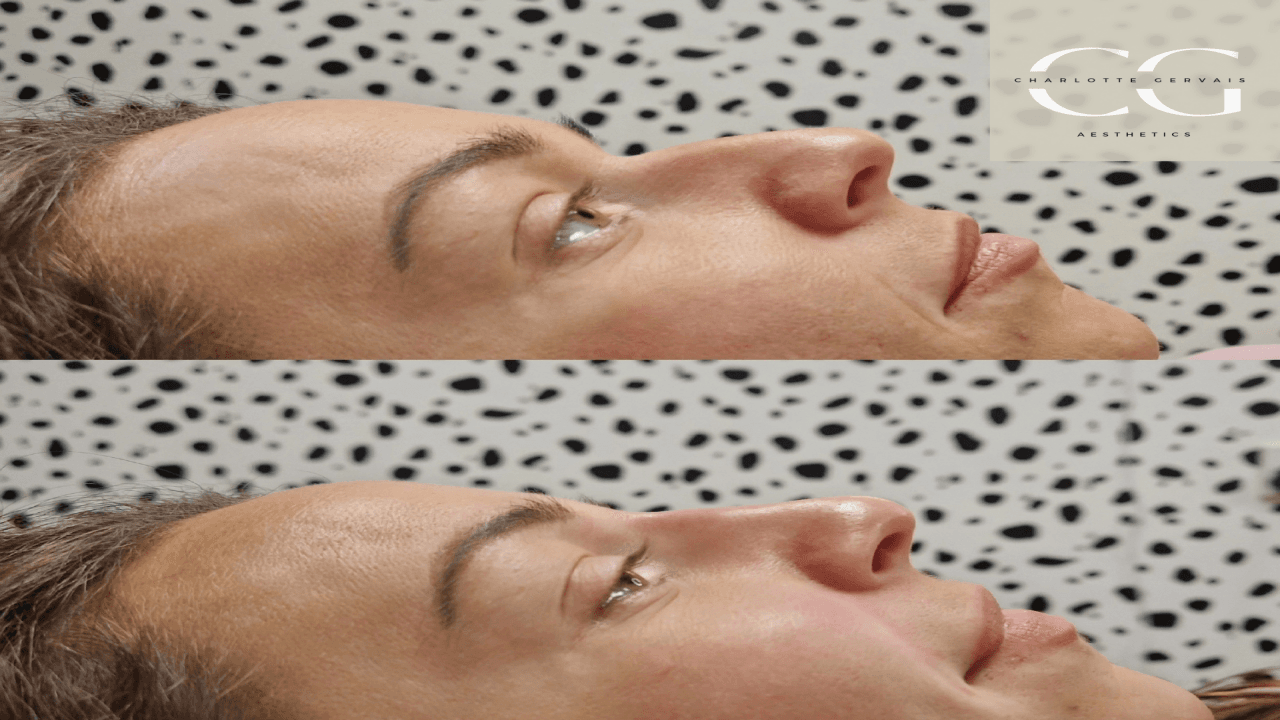 CG Aesthetics image 3