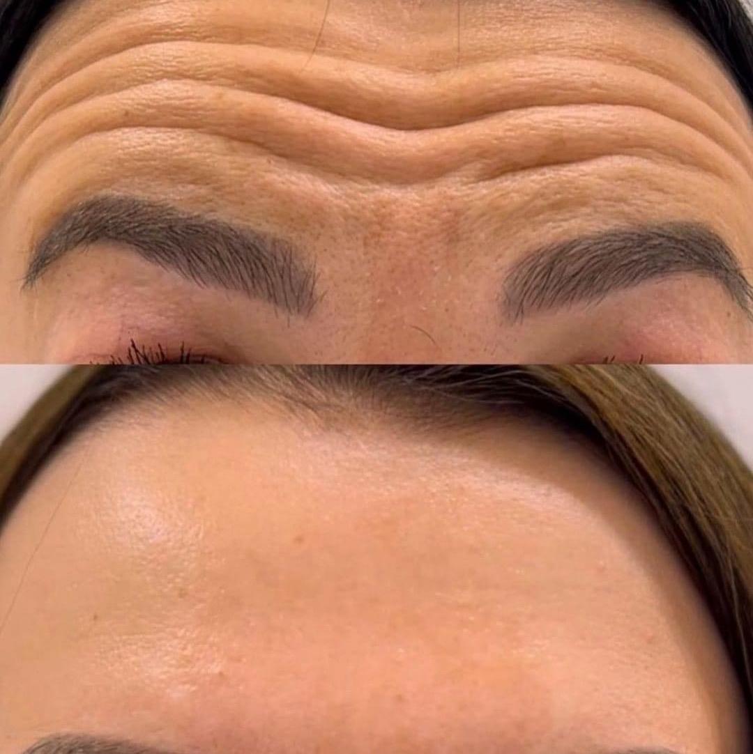 A-Star Aesthetics - Wisbech image 2