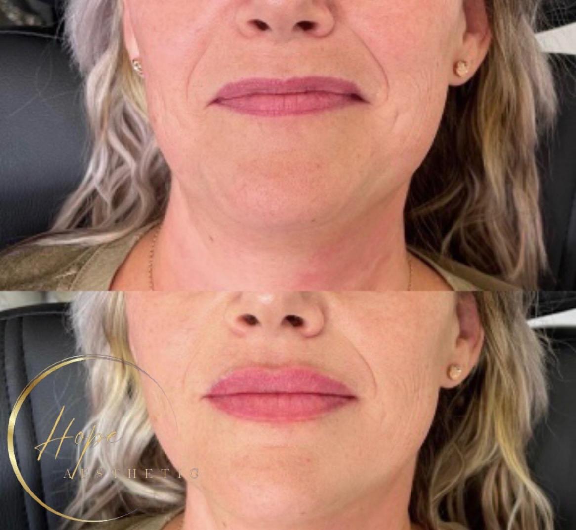 A-Star Aesthetics - Wisbech image 3