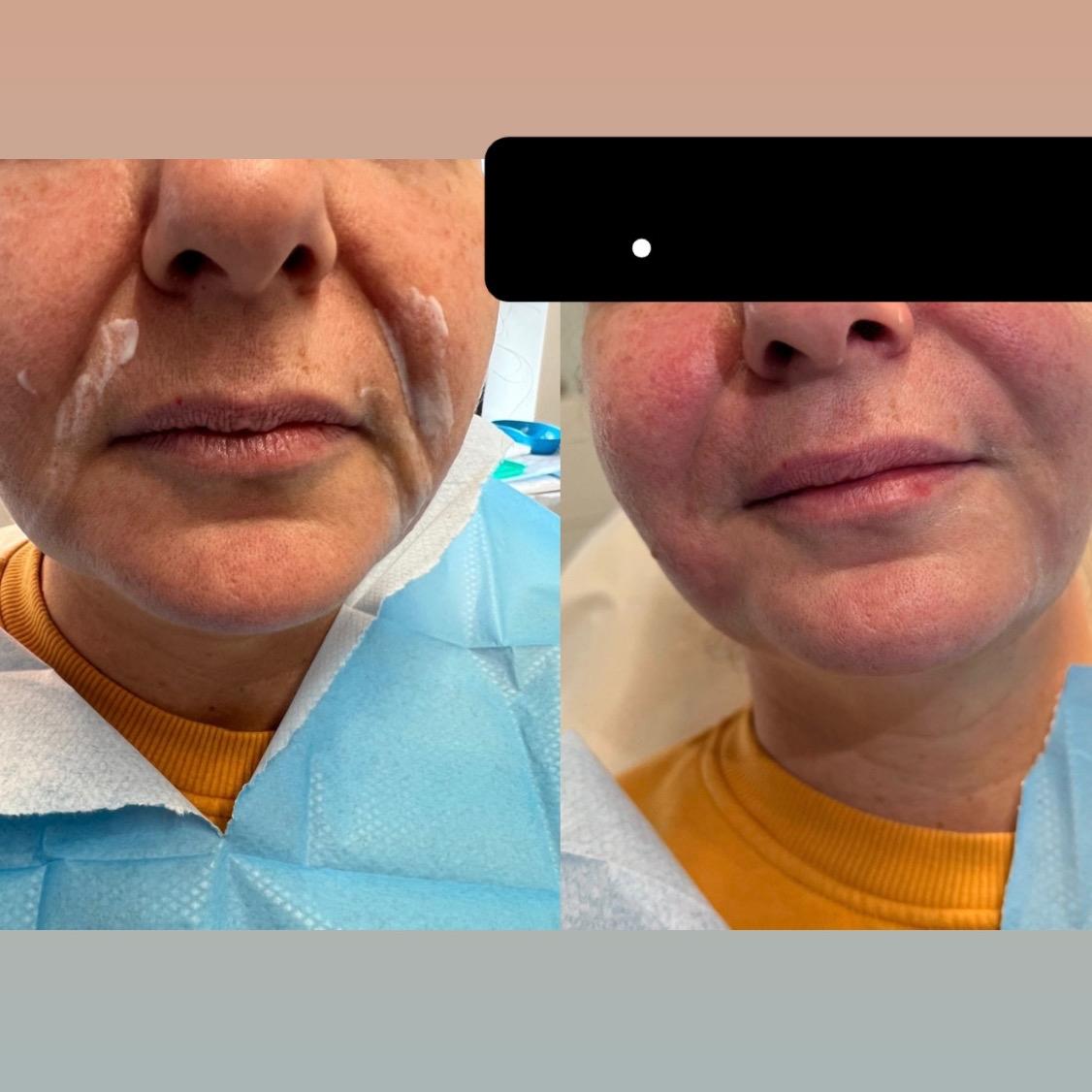 Lips by Liss clinic room image 2