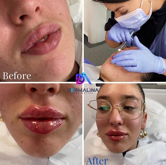 Dermalina Aesthetics image 3