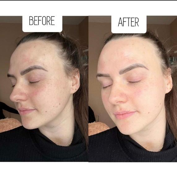 Revive skin clinic image 3
