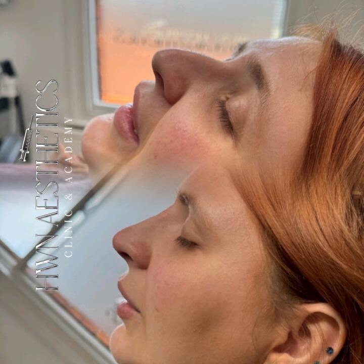 HWN Aesthetics Clinic image 2