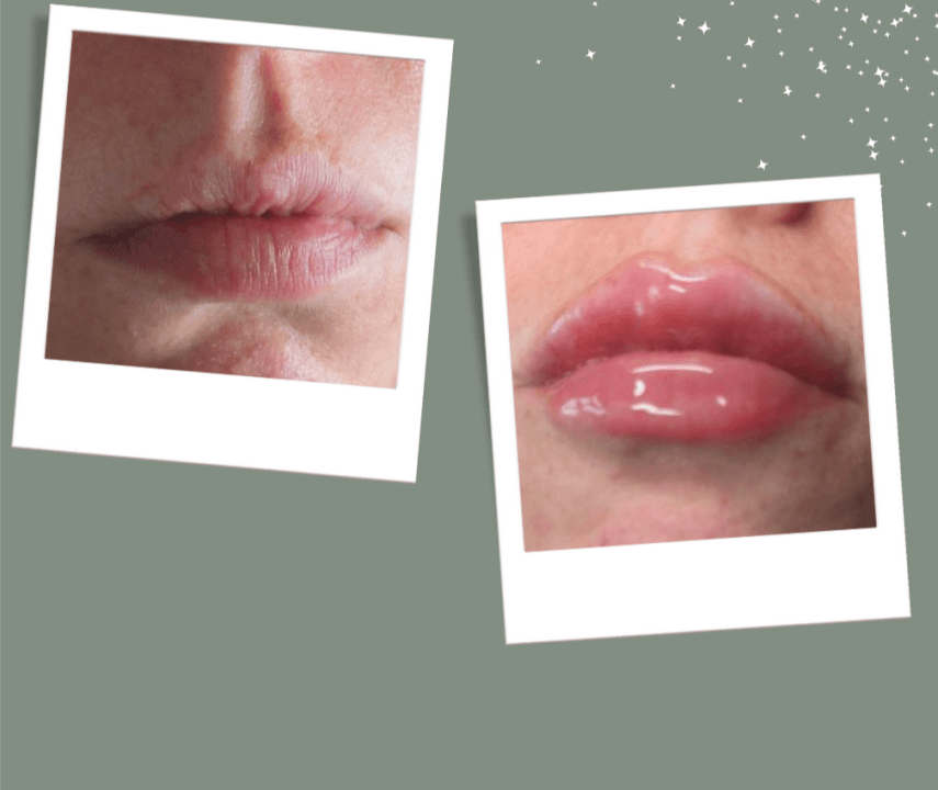 DM's Aesthetics Beauty Massage Hair image 3