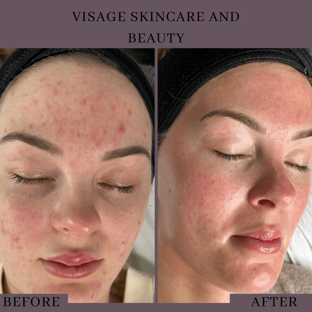 Visage Skincare and Beauty image 2