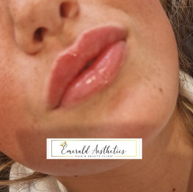 Emerald Aesthetics, Hair and Beauty Clinic image 2
