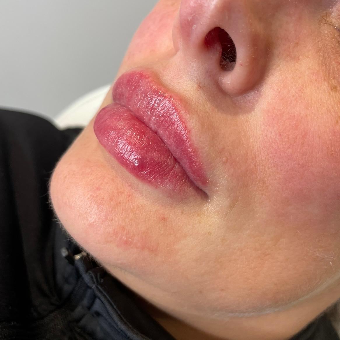 Zoe-Leigh clinical aesthetics image 2