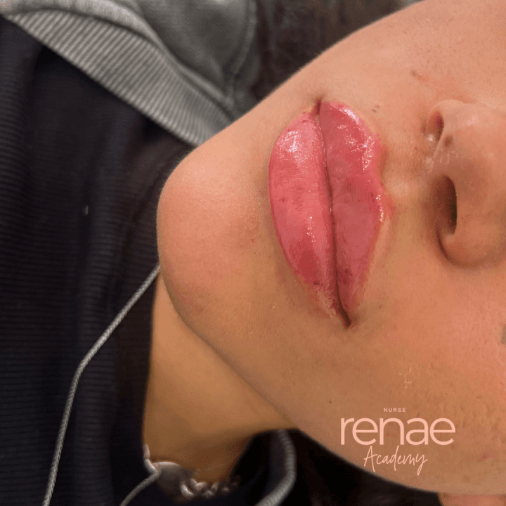 Nurse Renae academy image 2
