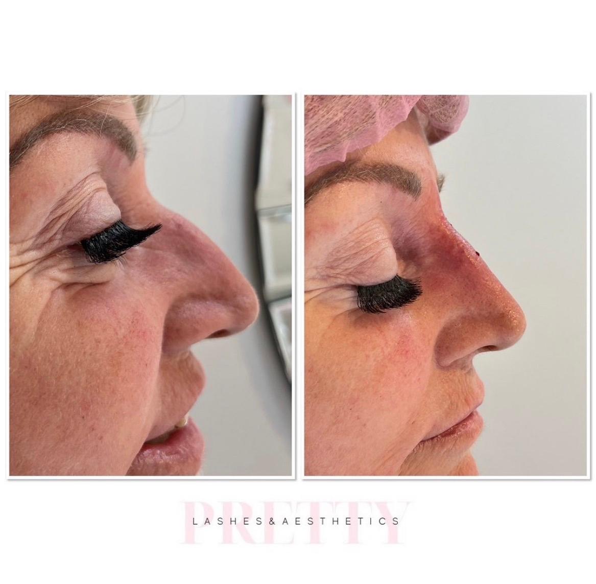 Prettylashes aesthetics image 2