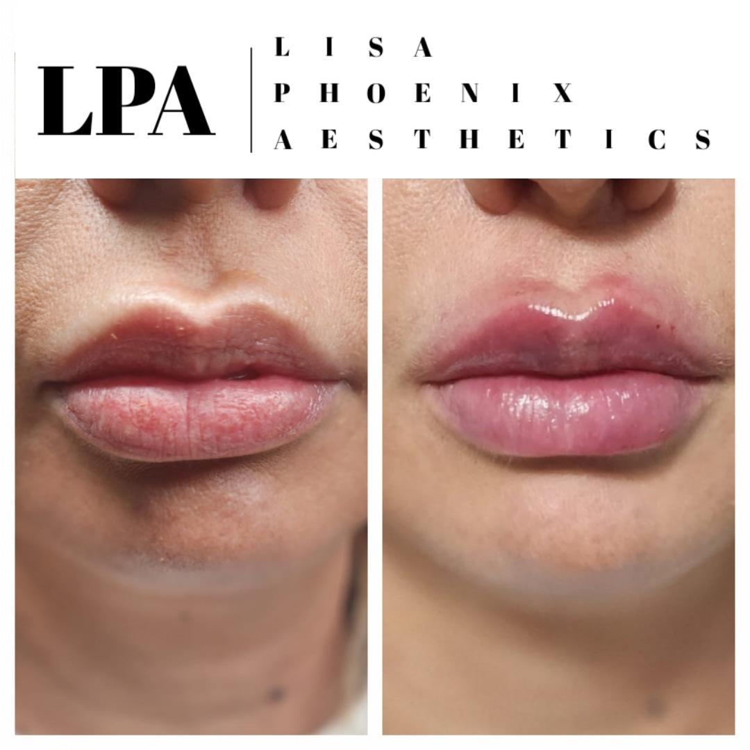 Lisa Phoenix Aesthetics image 2