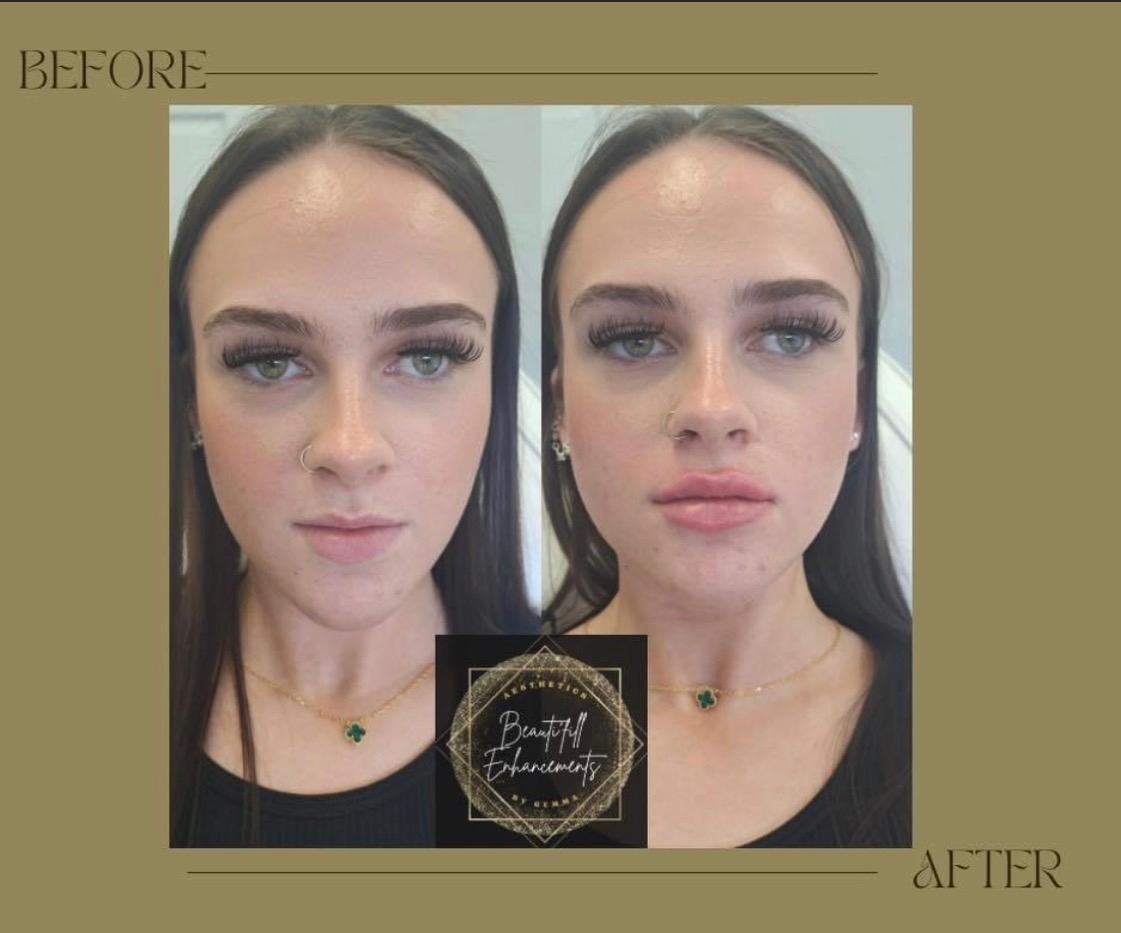Beautifill Enhancements image 2