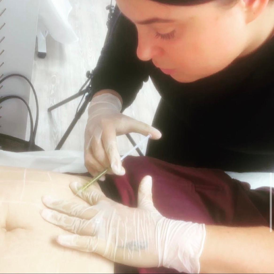 Injectables by Katie image 2