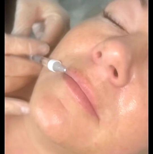 Injectables by Katie image 3