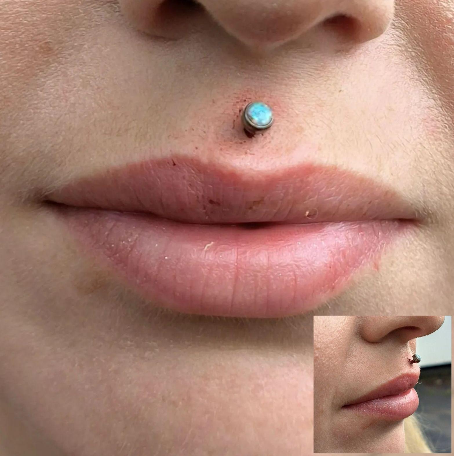 Skin Stations image 1