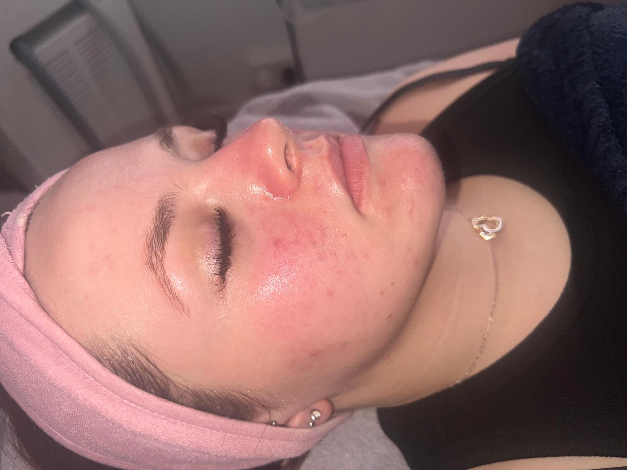 Effortless skin and laser clinic image 2
