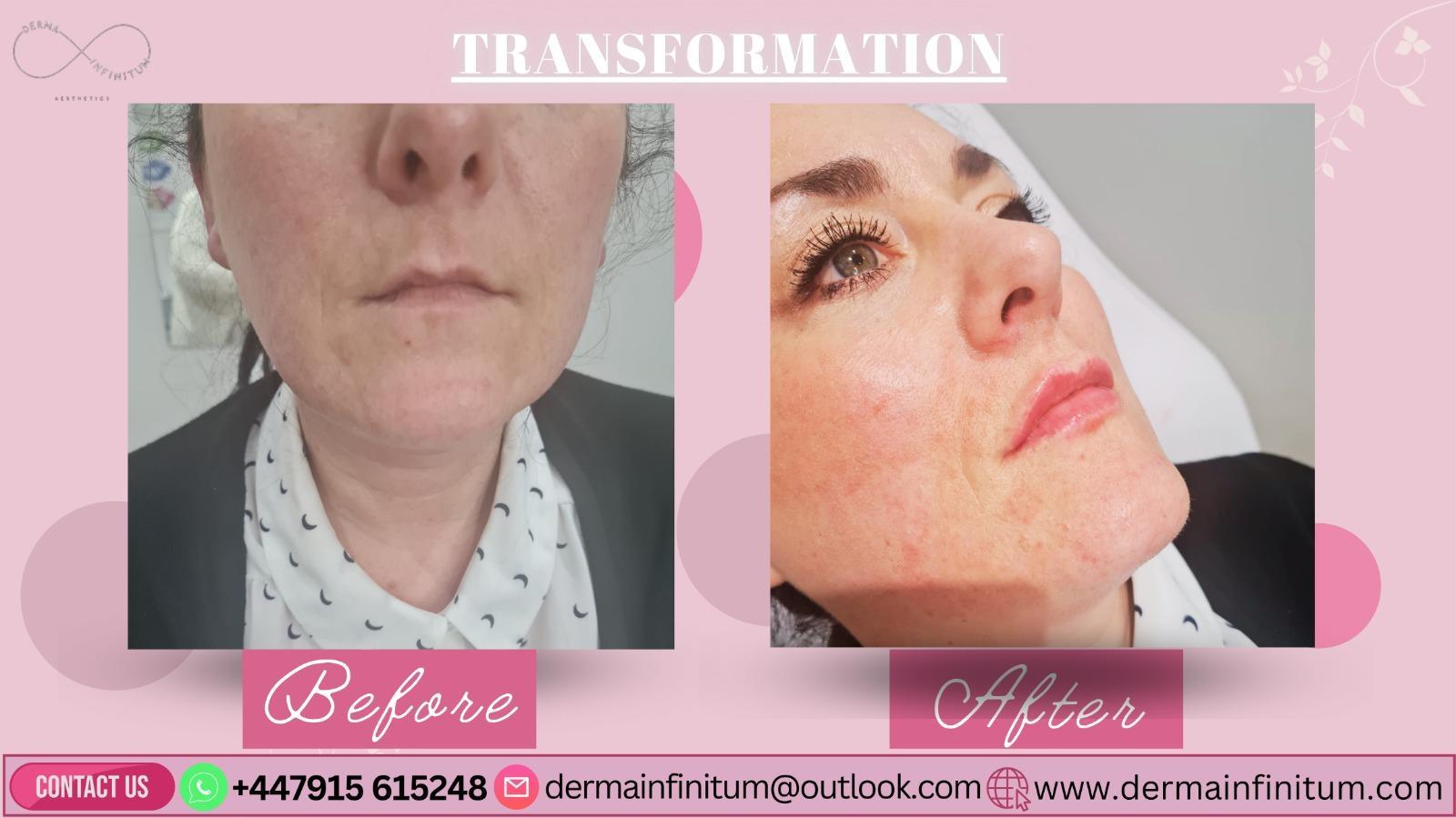 Derma Infinitum Aesthetics image 2