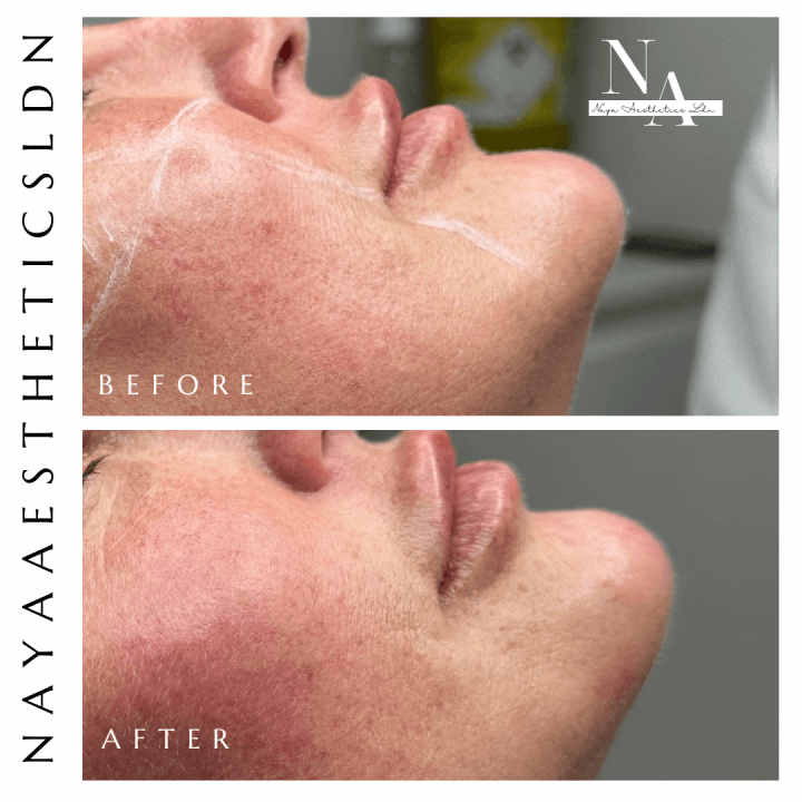 Naya Aesthetics Clinic image 3
