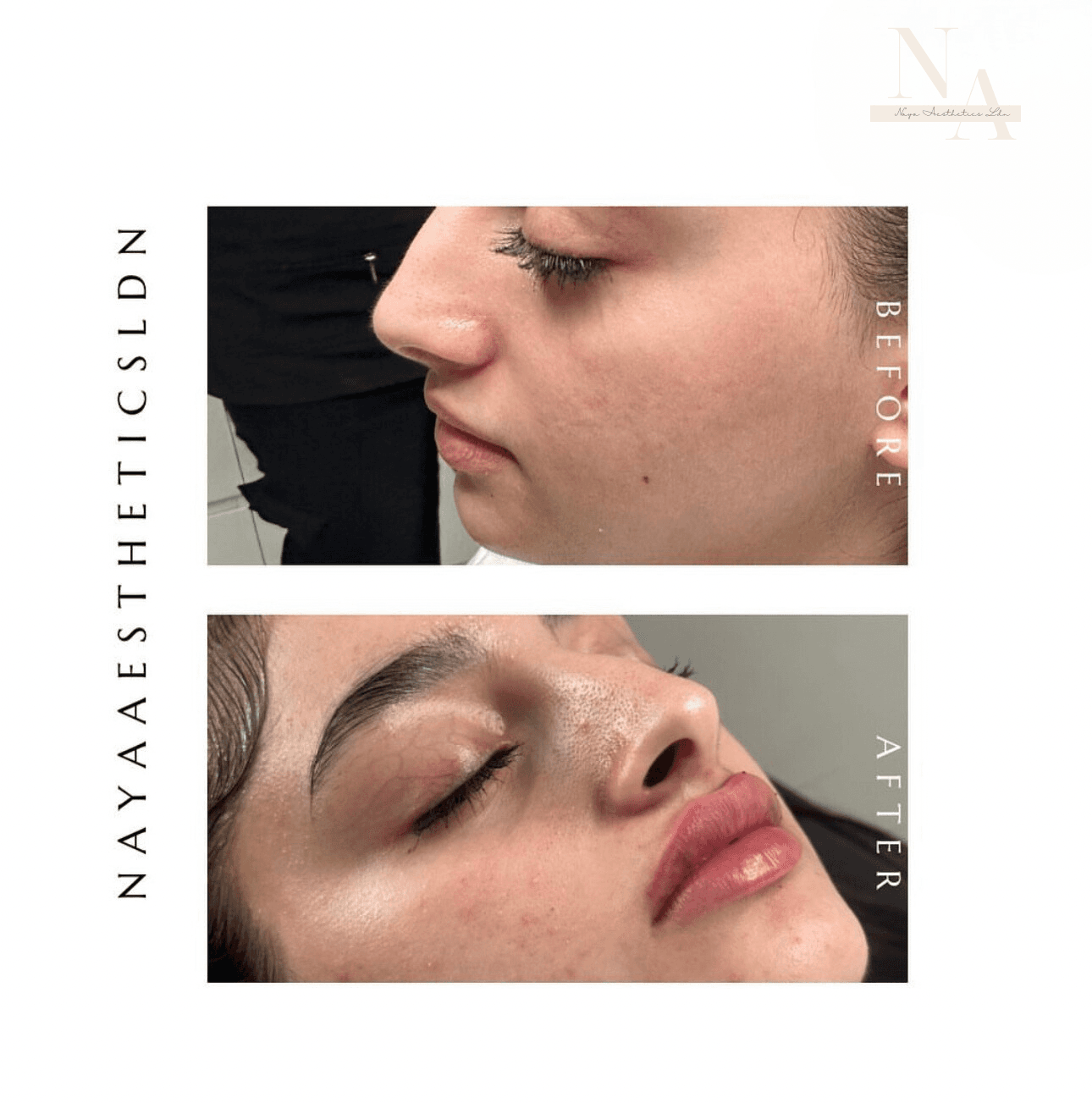 Naya Aesthetics Ldn image 1