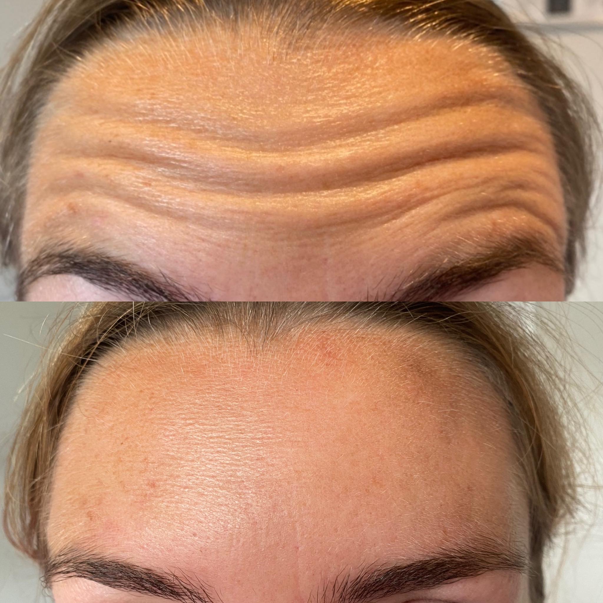 Facial aesthetics by Rhoda image 1