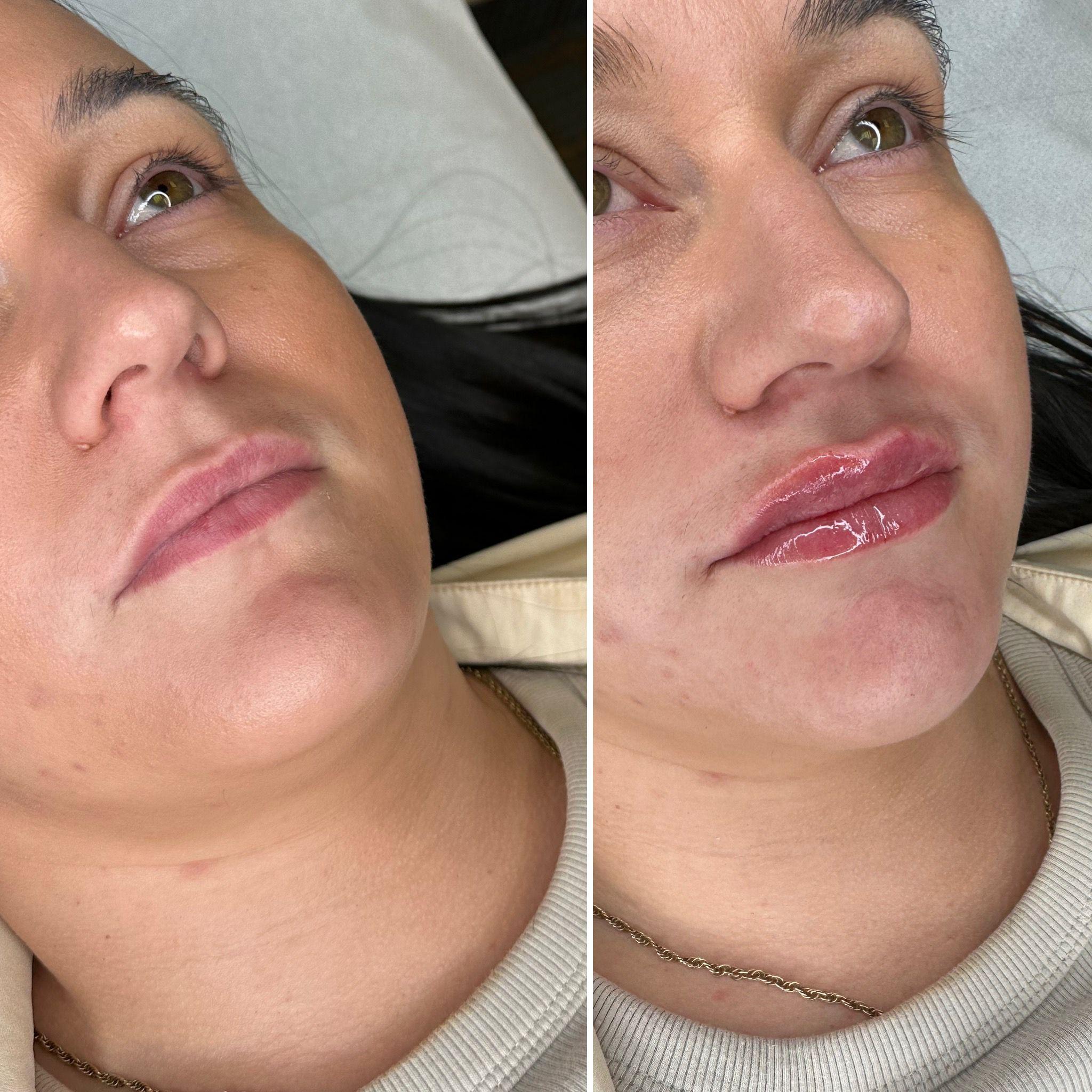 Nova Derma Aesthetics image 3