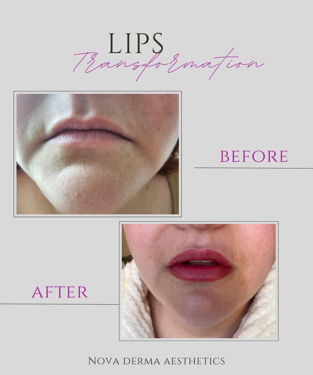 Nova Derma Aesthetics image 1