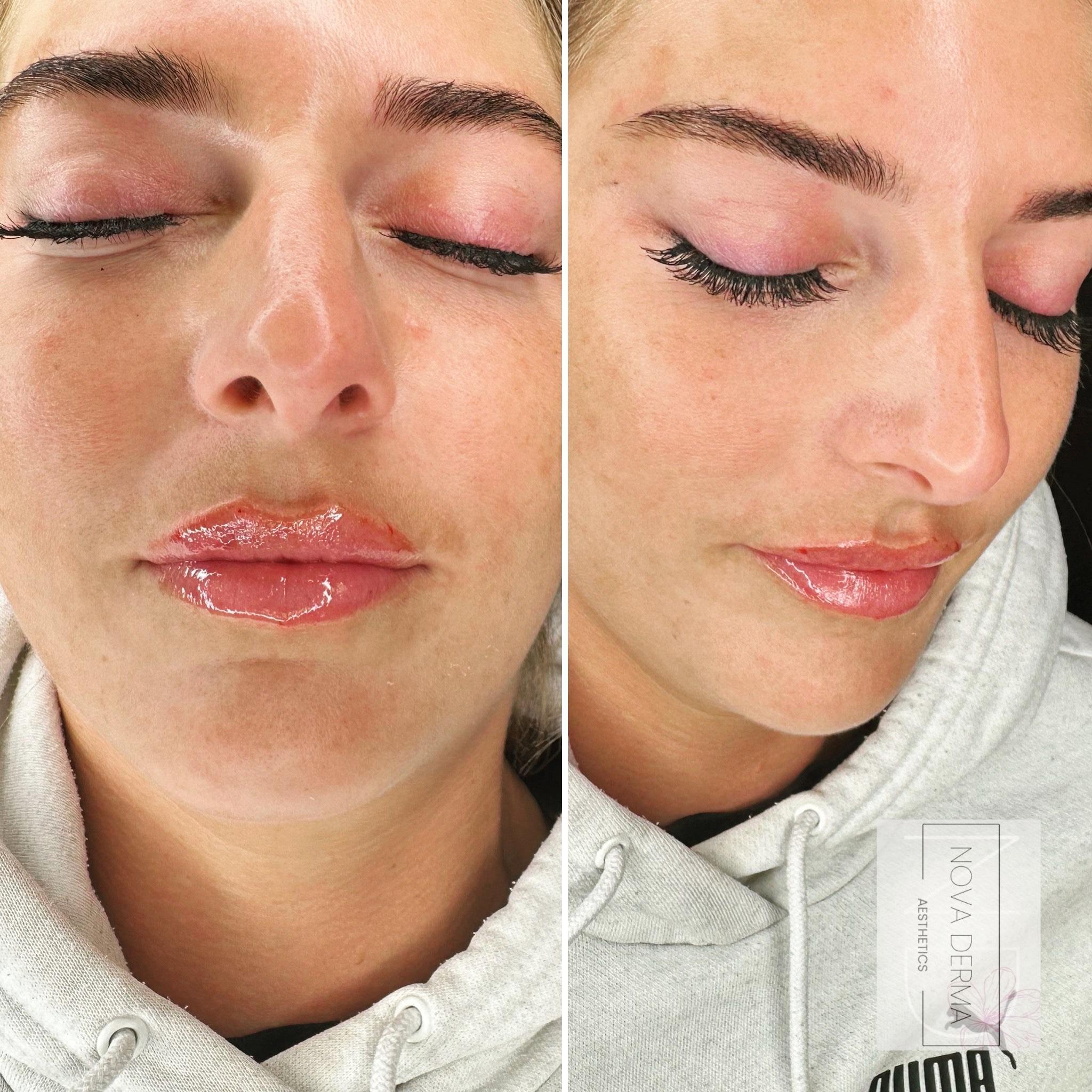 Nova Derma Aesthetics image 2