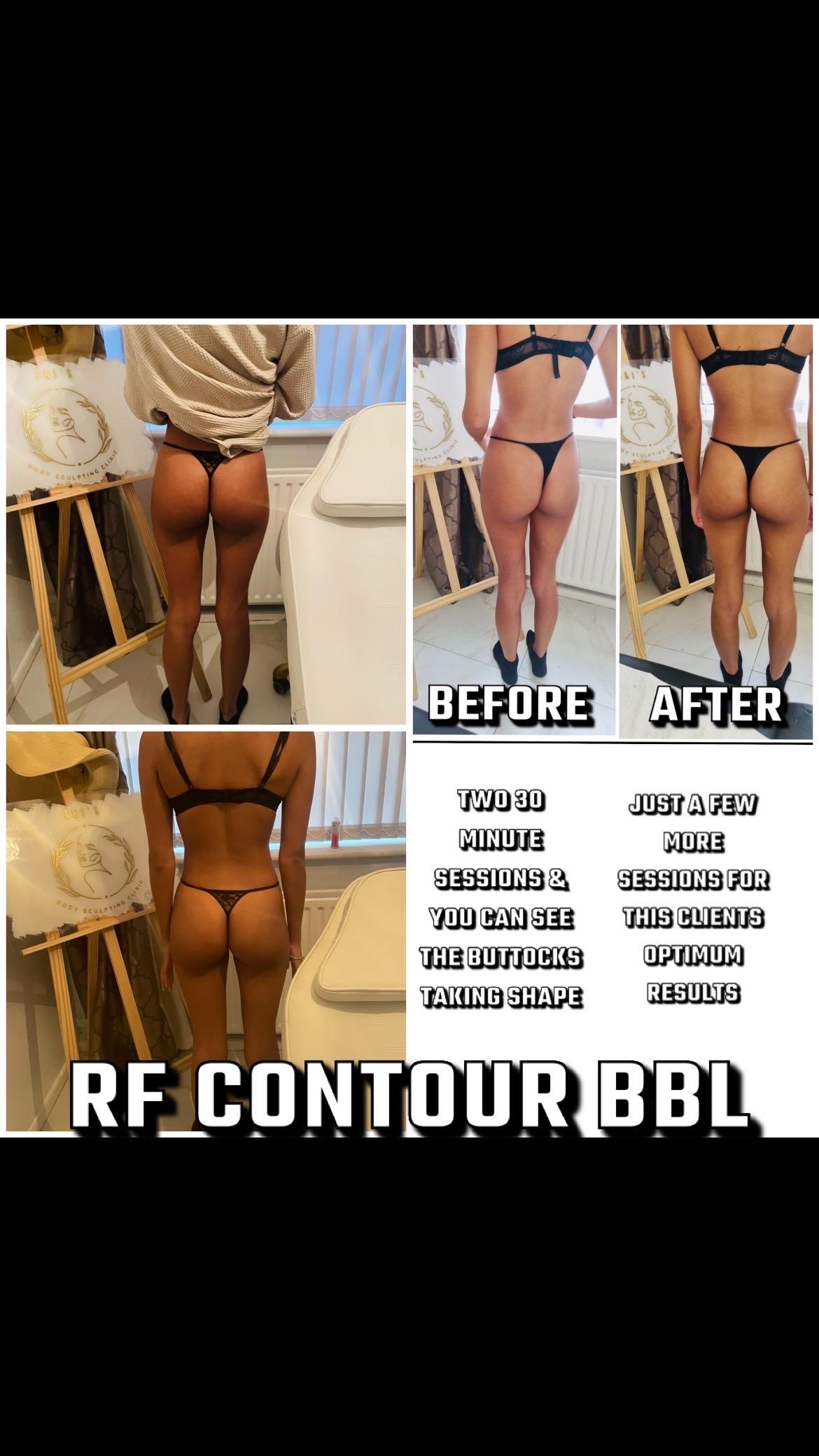 JnJs Body Sculpting clinic image 2