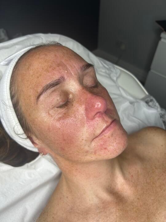 Grow and glow by Nadine skin clinic image 2