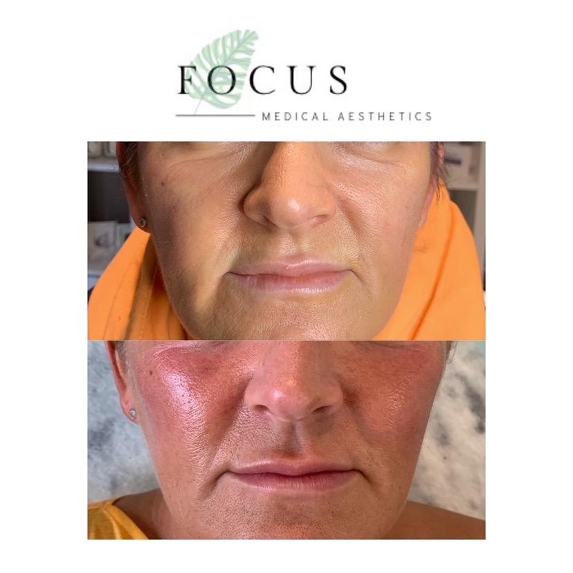 Focus Aesthetics image 2