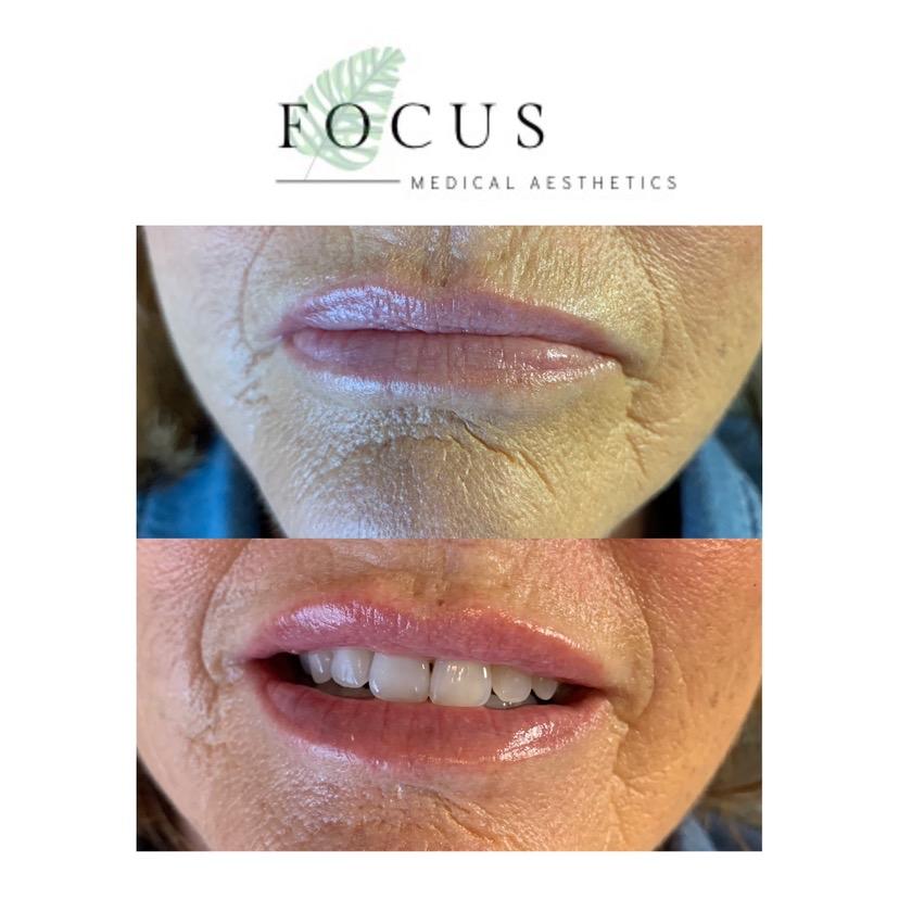 Focus Aesthetics image 3
