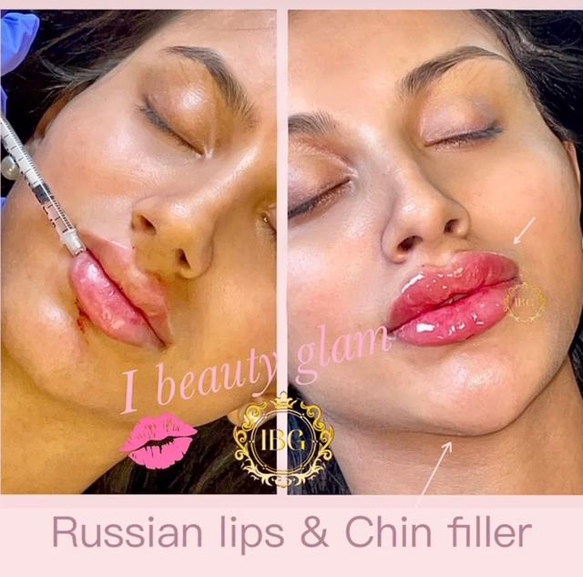 I Beauty Glam