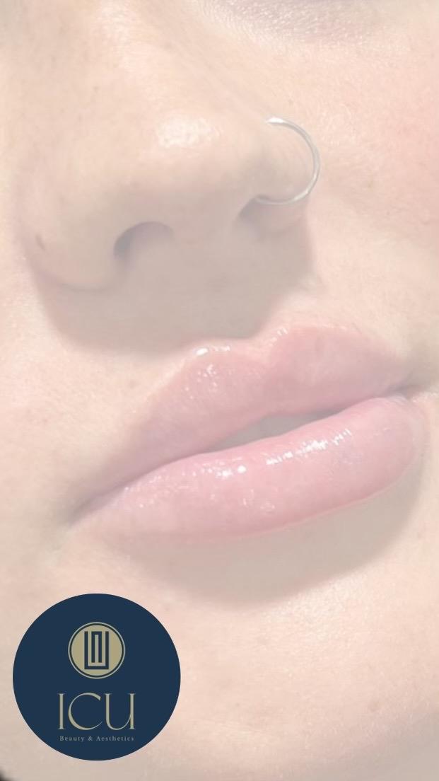 ICU Beauty and Aesthetics image 3