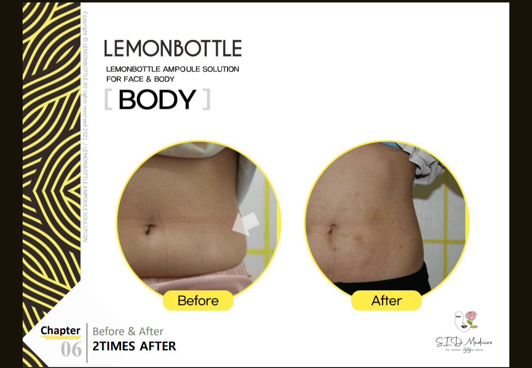 Lemon bottle  manyshadesofbeautyco image 2