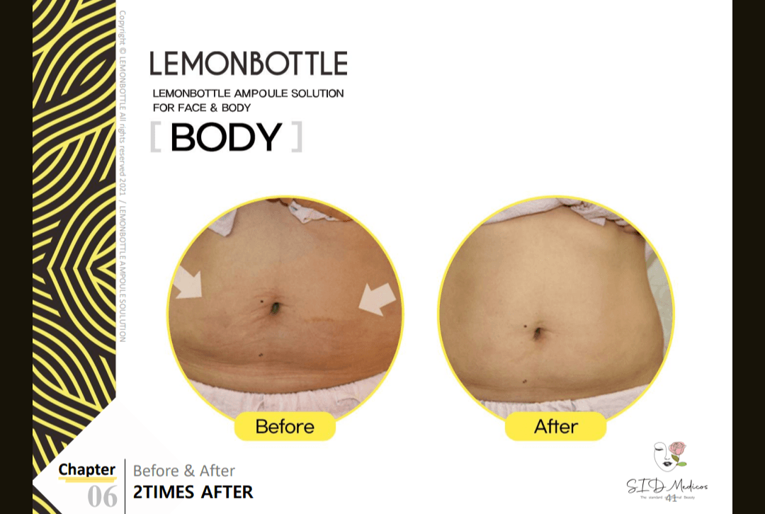 Lemon bottle  manyshadesofbeautyco image 1