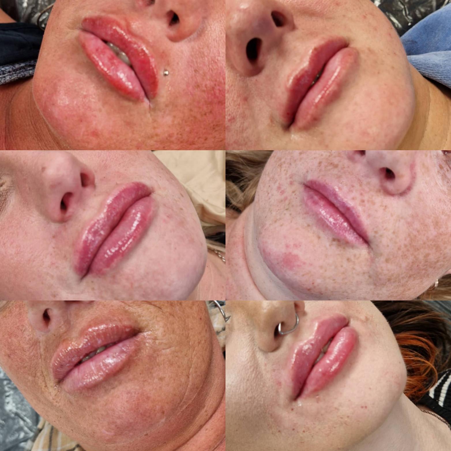 Lois' Aesthetics and Massage image 1