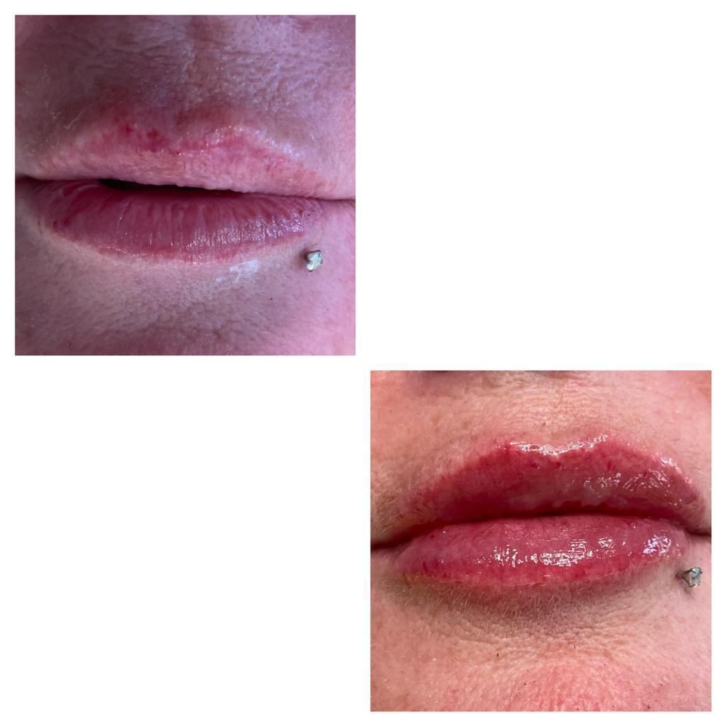ReGlow SKIN image 3