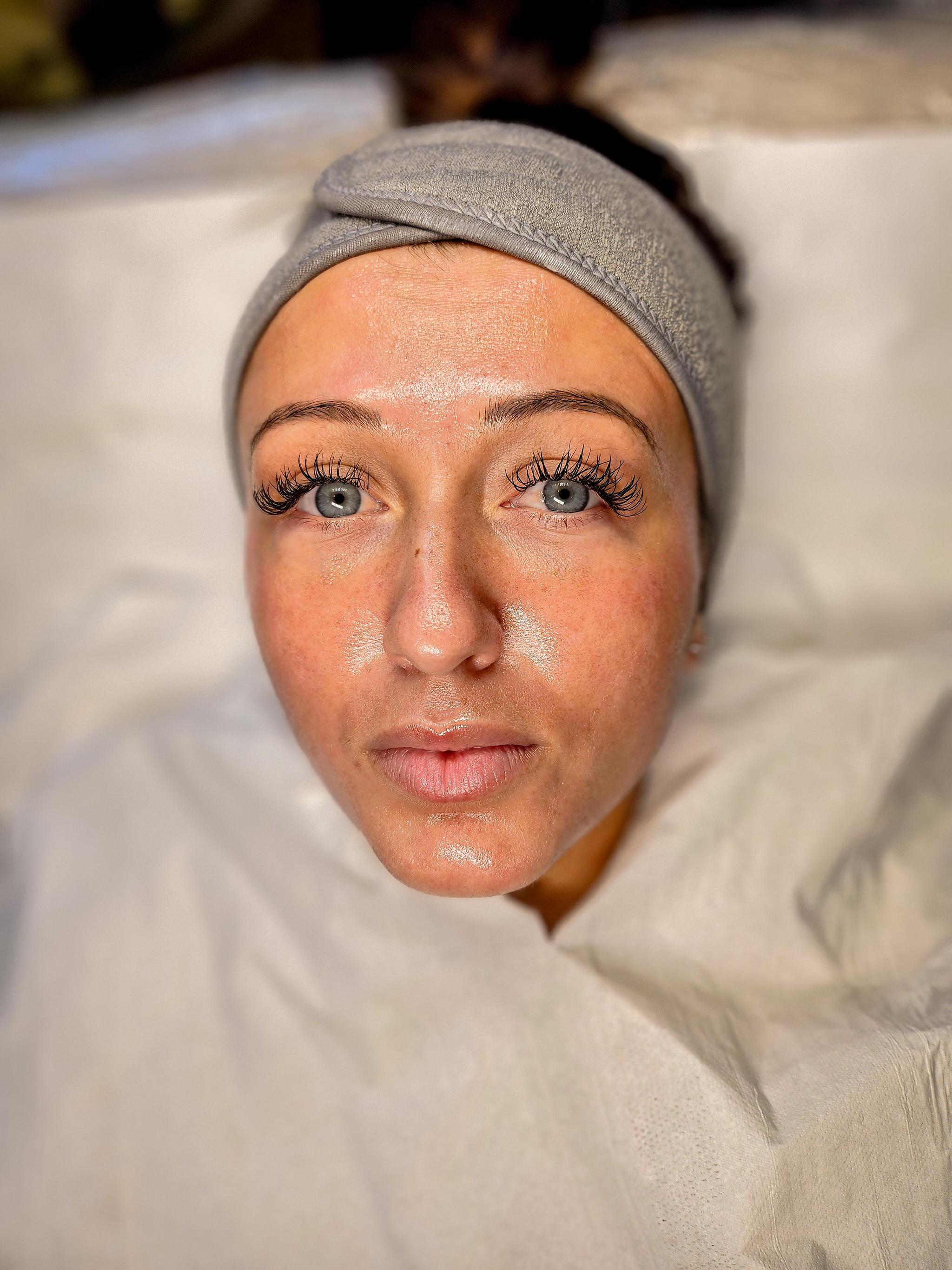 Skkinbyloren image 1