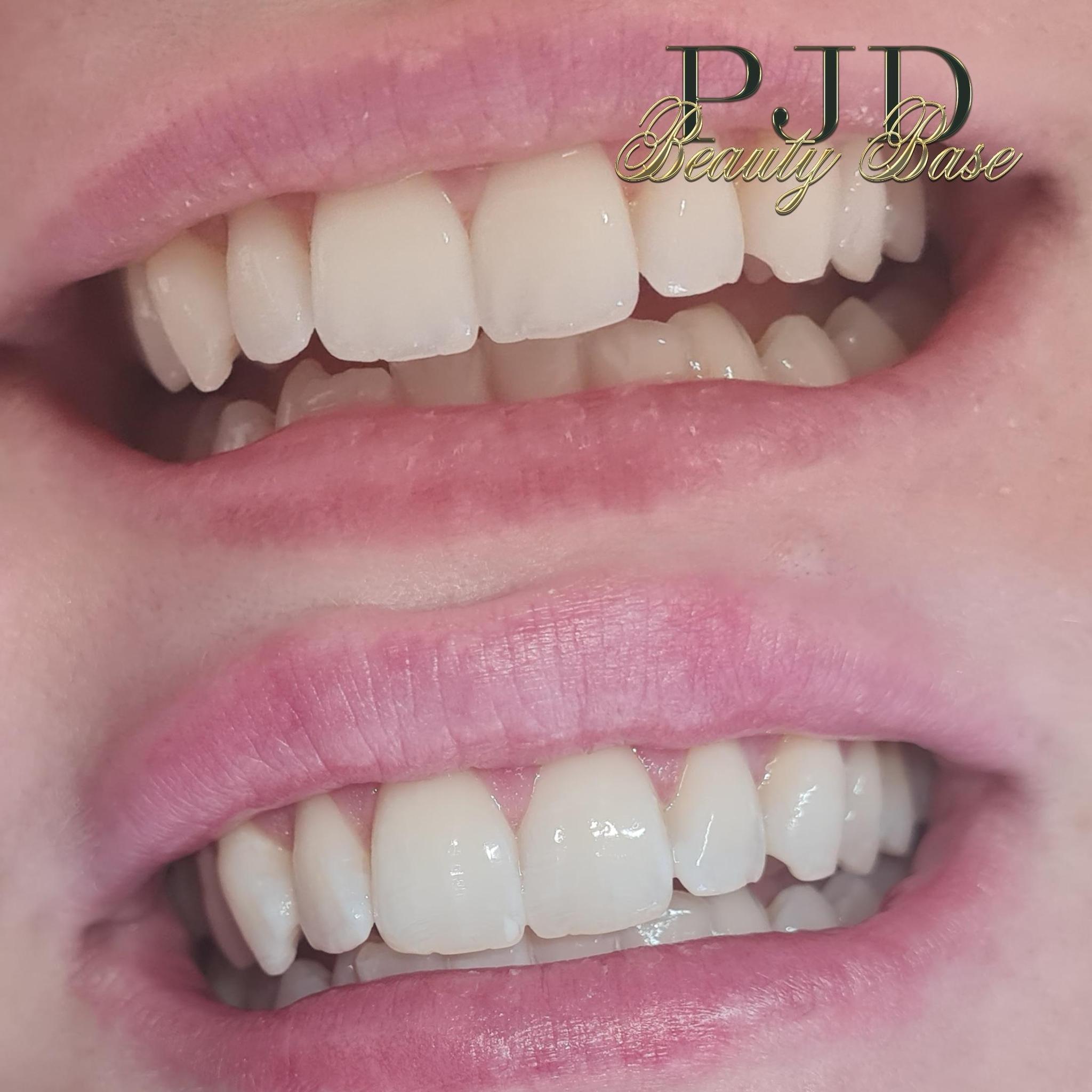 PJD beauty base image 3