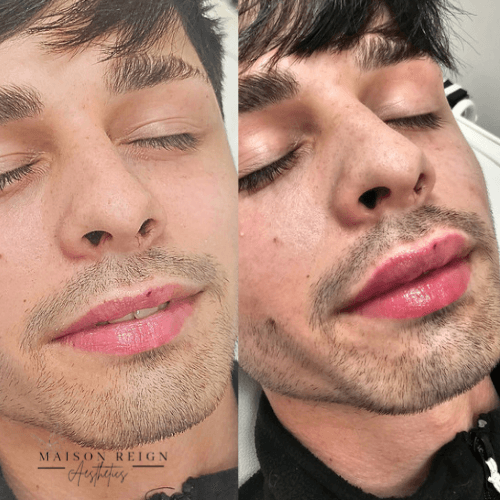 Maison Reign Aesthetics  image 3