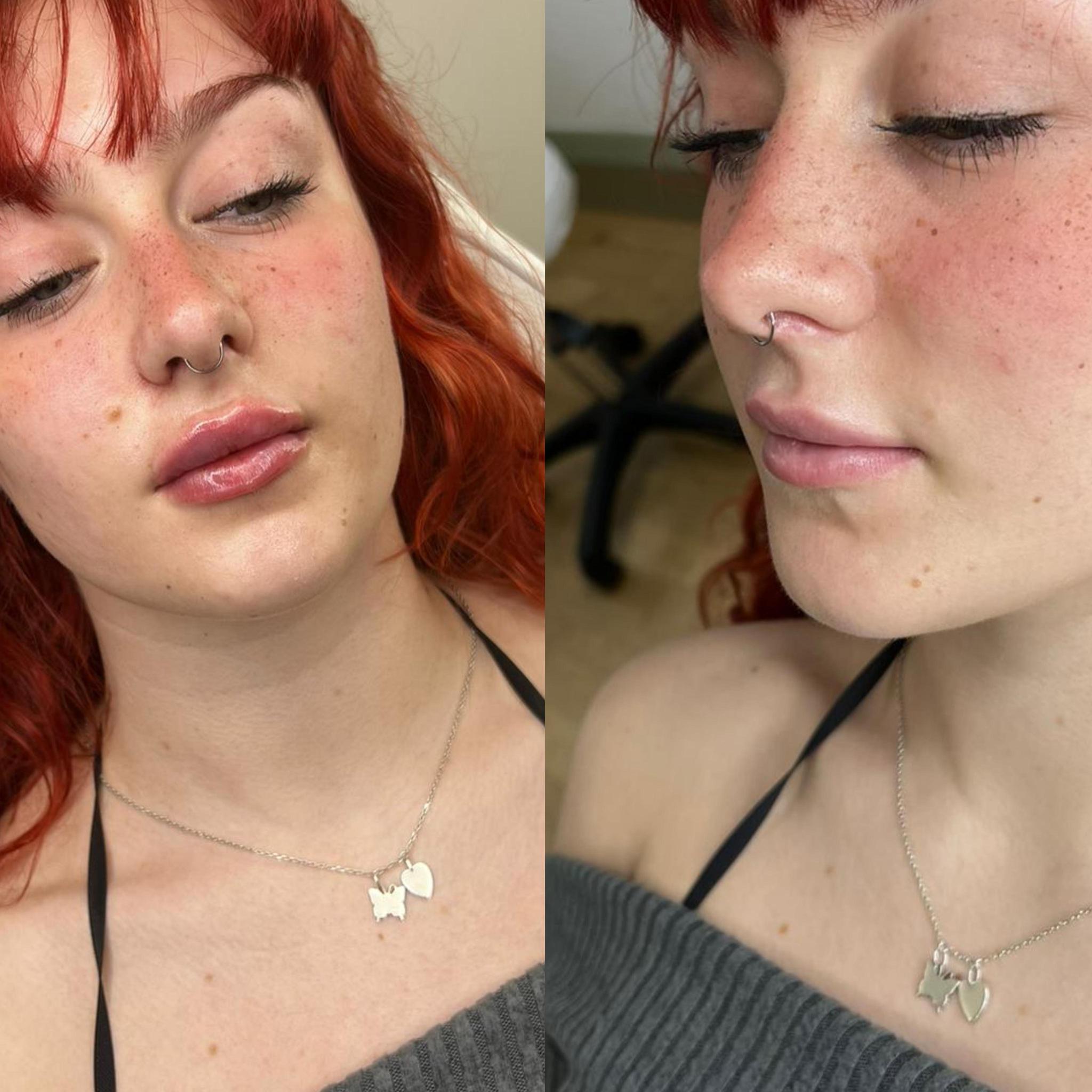 Sophie-rose aesthetics image 3