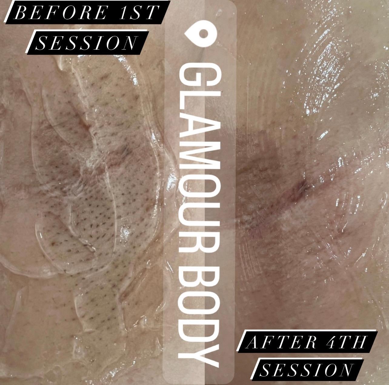 Glamour Body image 2