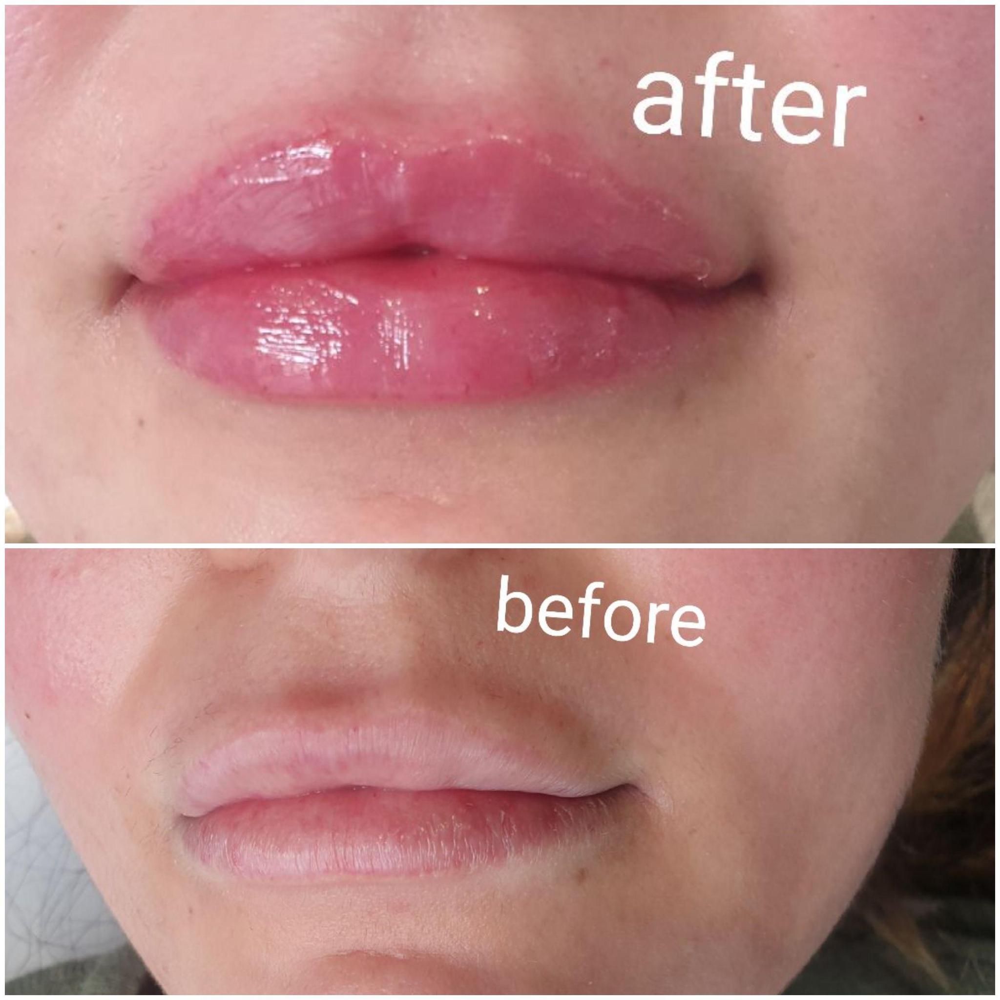 Skin Recovery image 1