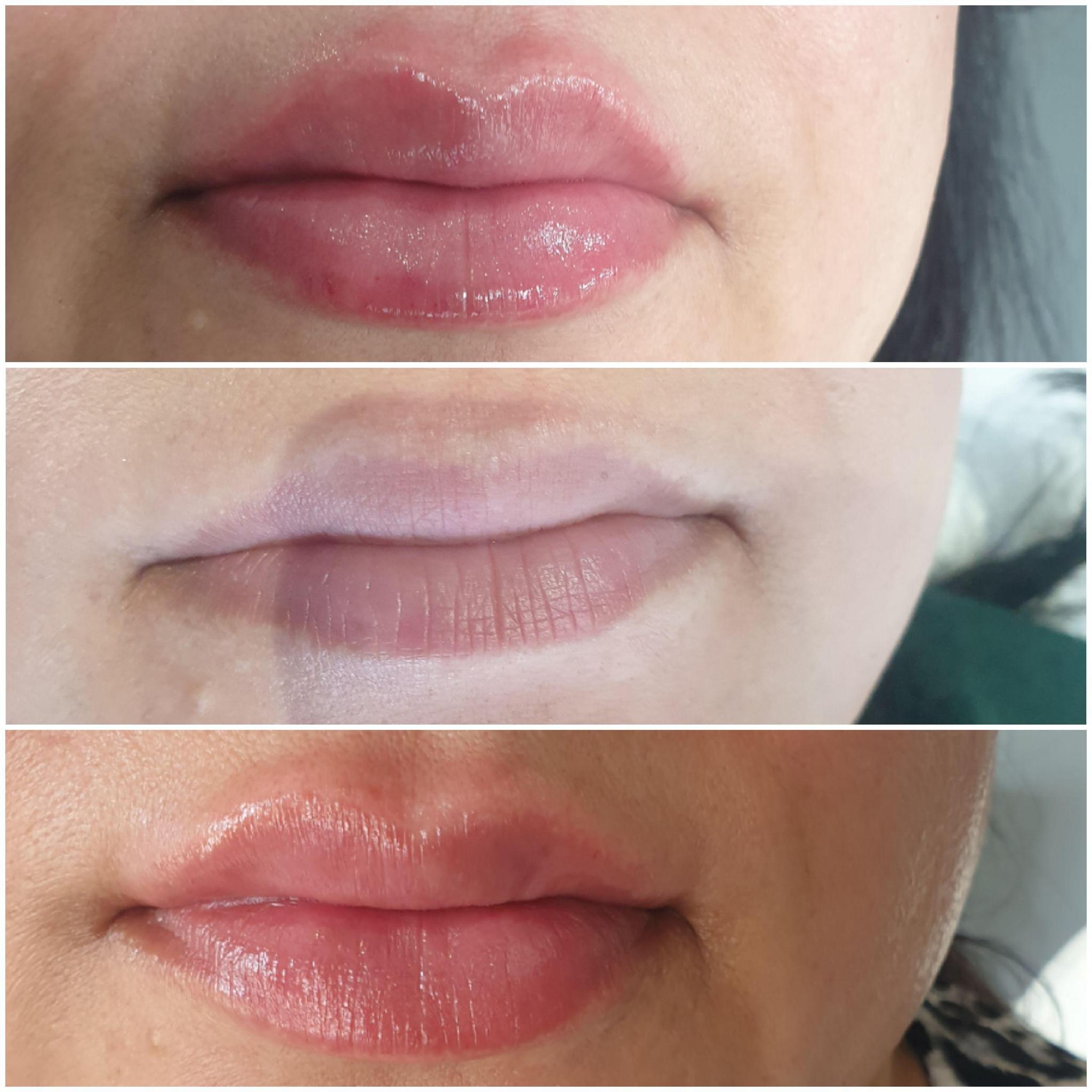 Skin Recovery image 3