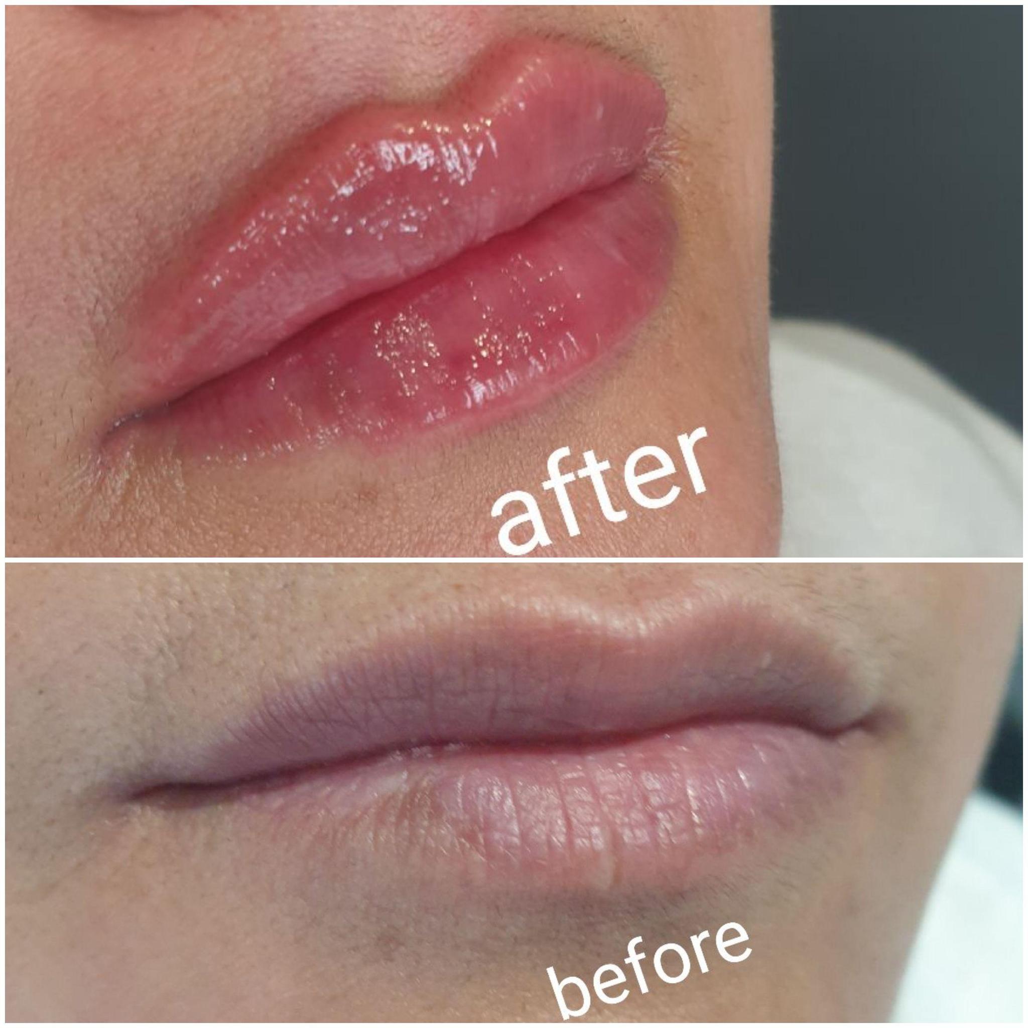 Skin Recovery image 2