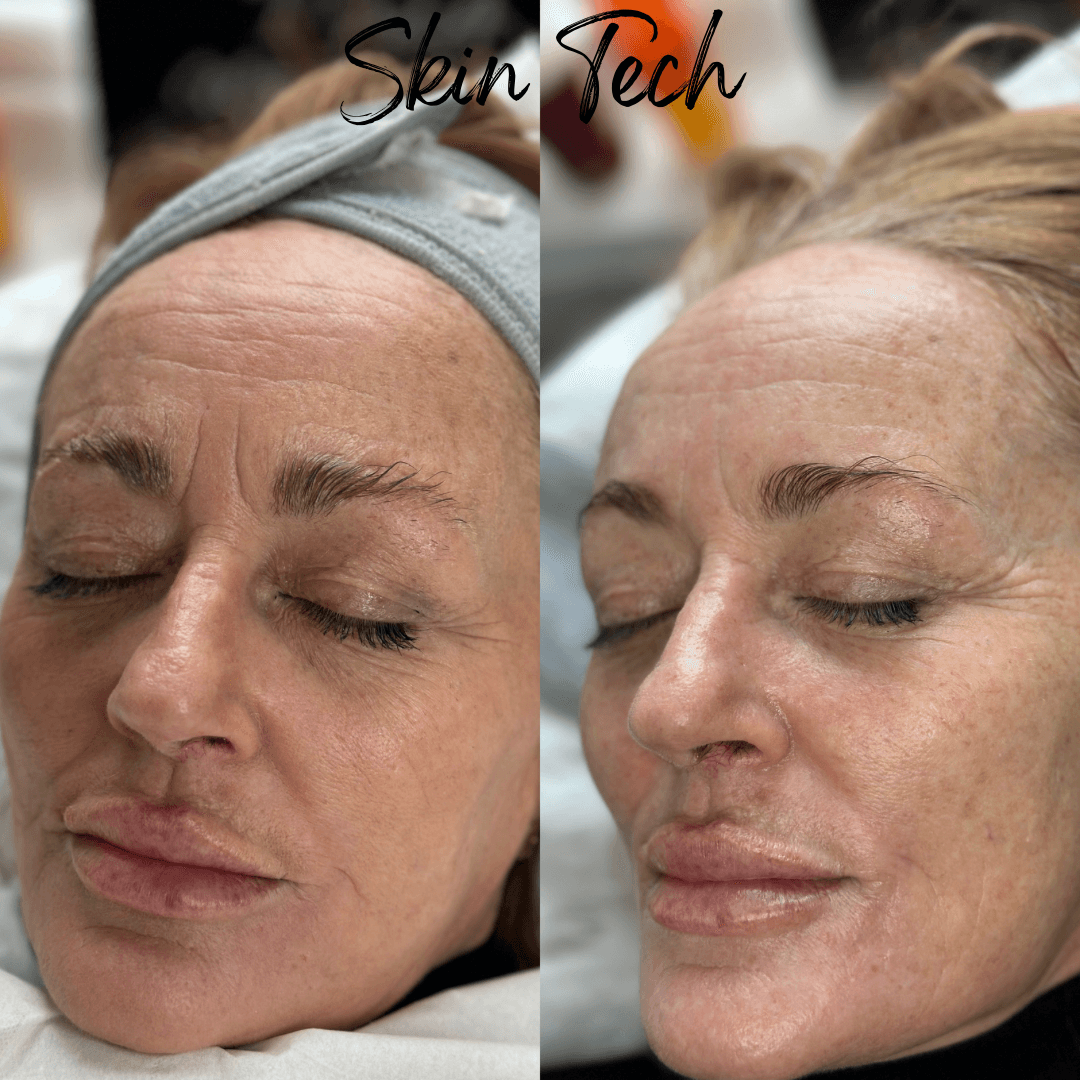 SkinTech image 3