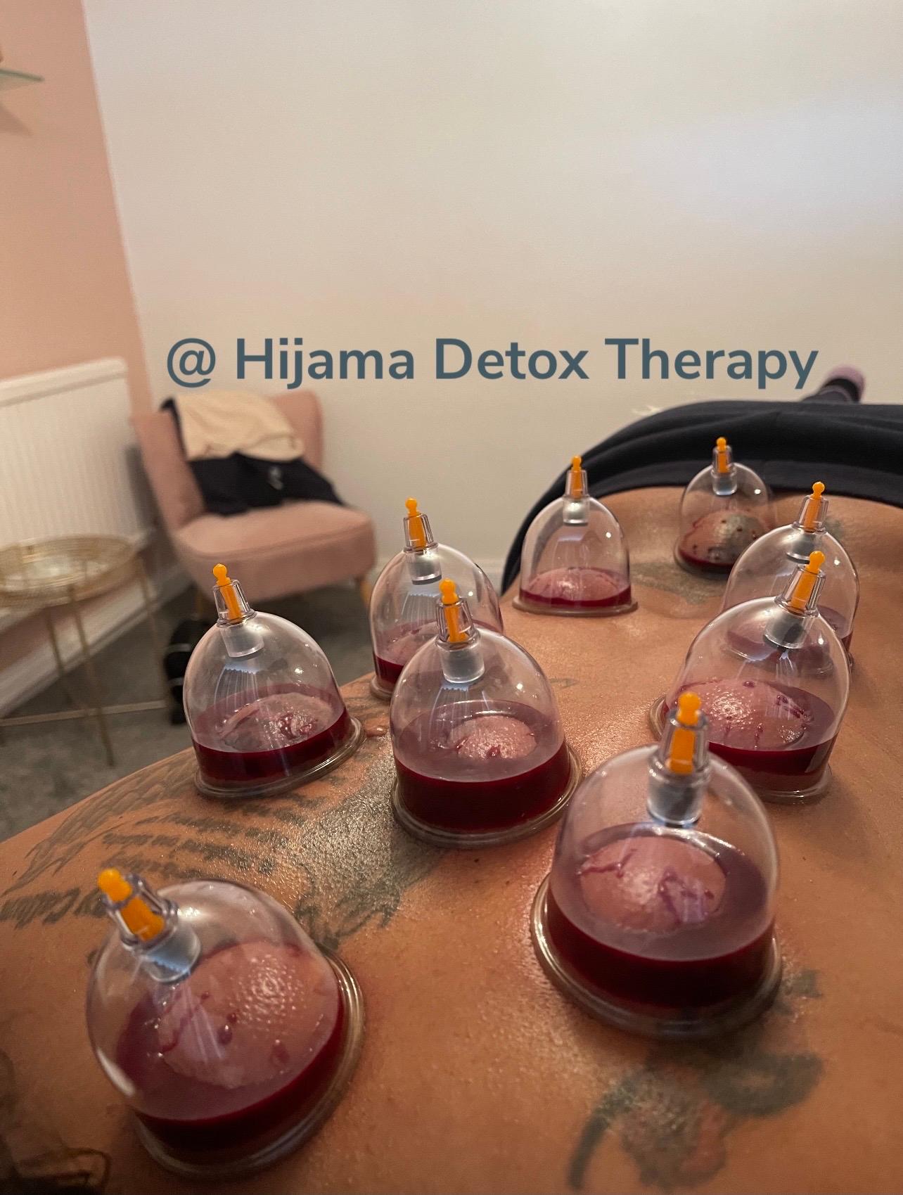 Hijama Detox Therapy image 3