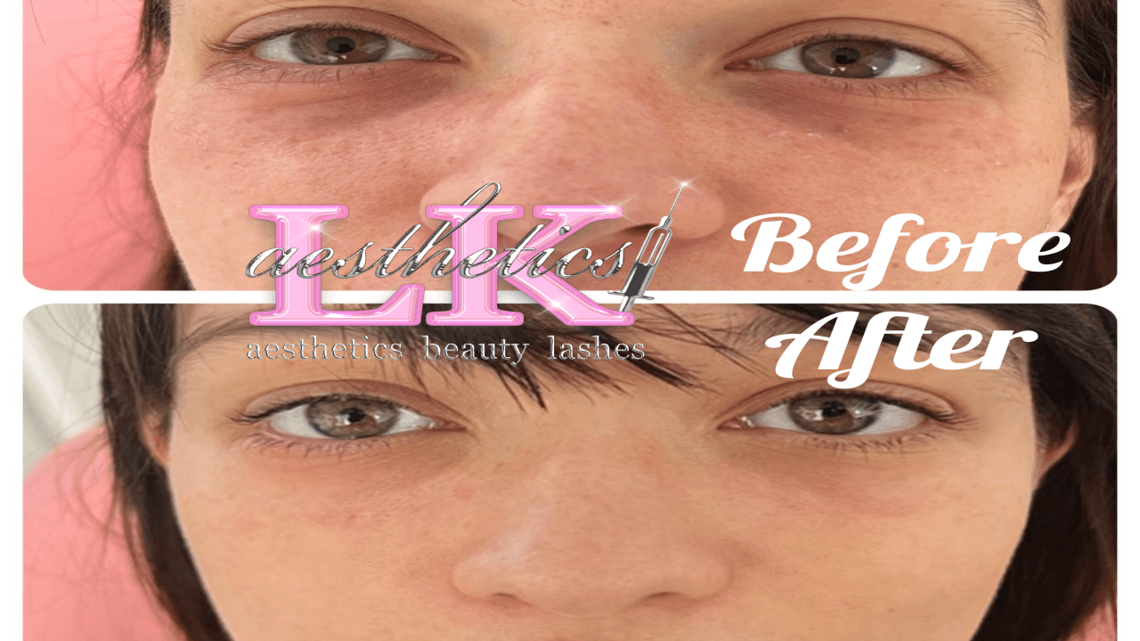 LK Aesthetics image 3